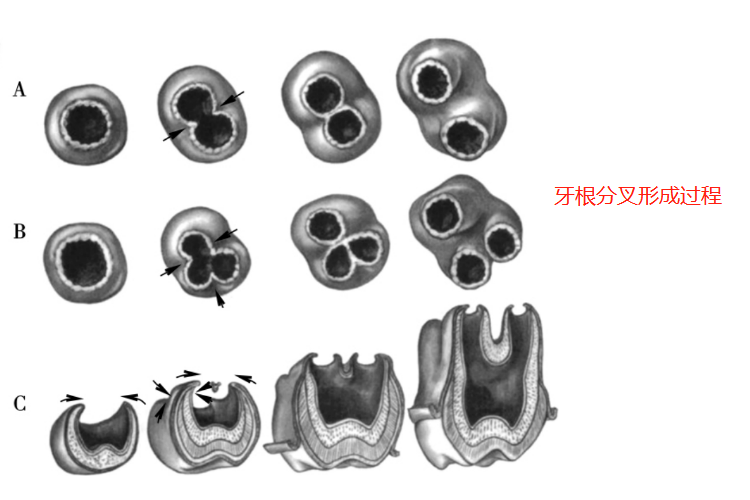 牙根分叉过程图