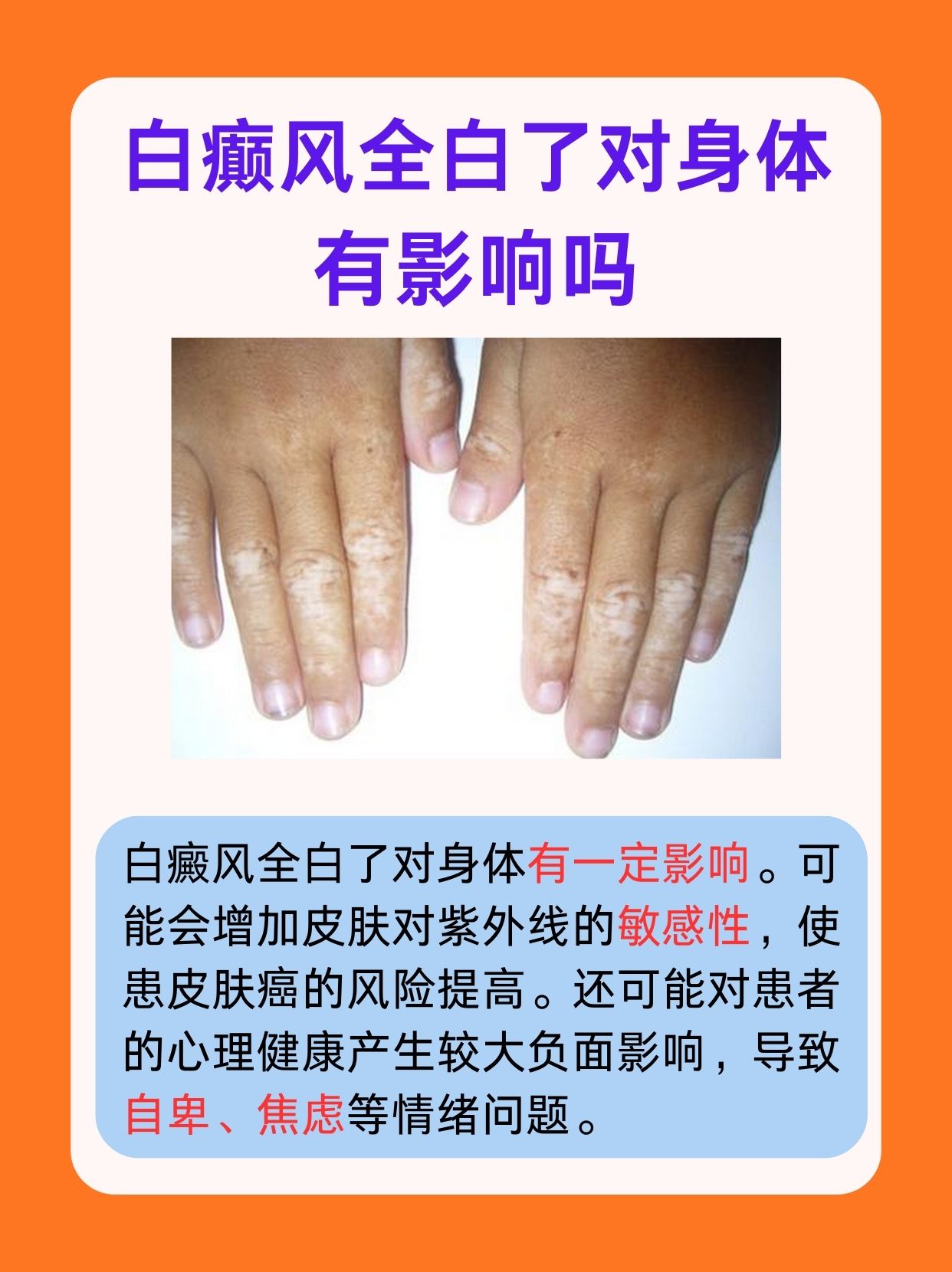 一文解析，白癫风全白了对身体有影响吗