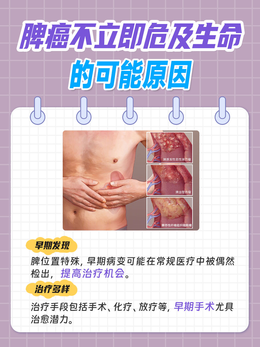 脾癌与生命影响：脾癌为什么不影响生命