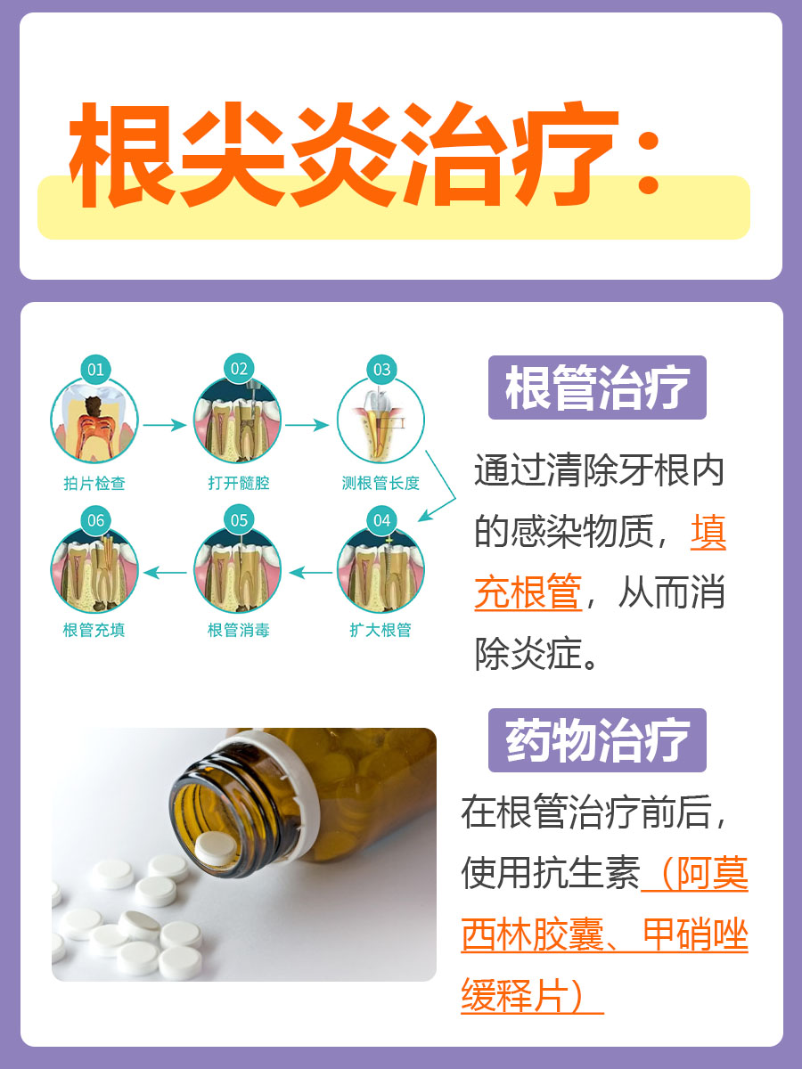 根尖炎全攻略：症状、治疗方法