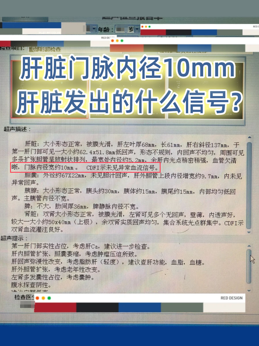 肝脏门脉内径10mm，肝脏发出的什么信号？