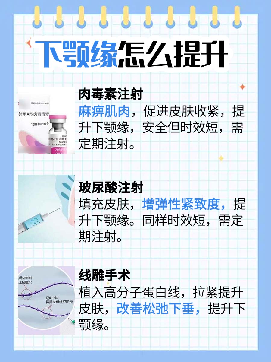 ​下颌缘提升改善轮廓，医生告诉你