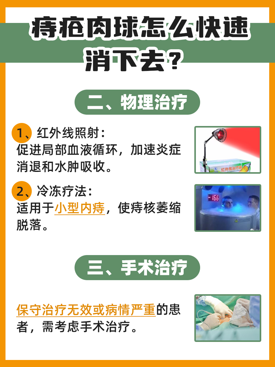 痔疮肉球速消指南:专业医生教你科学应对
