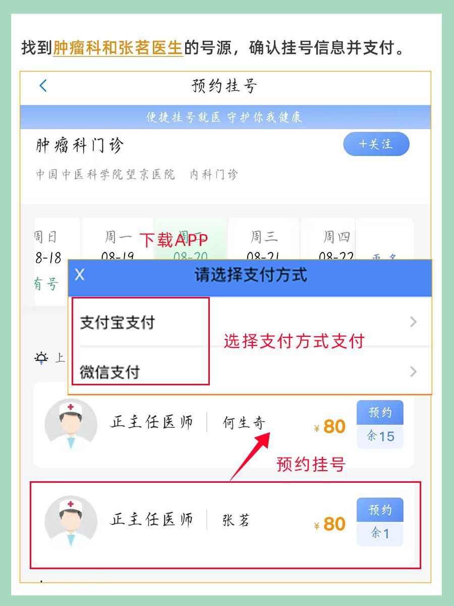 北京望京医院张茗医生怎么样?怎么挂号?