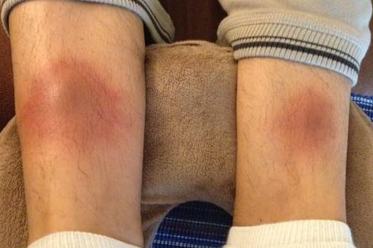 热毒壅聚无名肿毒红肿图