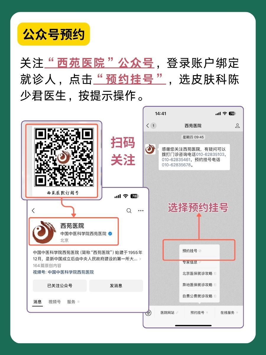 北京西苑医院陈少君医生怎么样?怎么挂号?