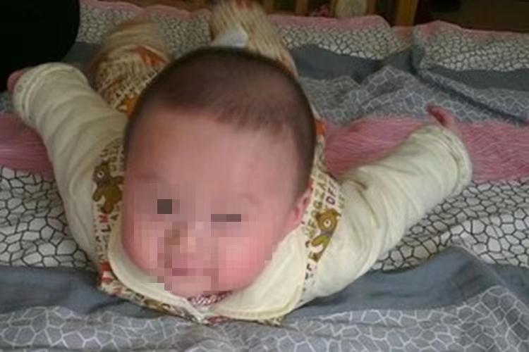 脑瘫婴儿飞机手图 脑瘫婴儿飞机手图