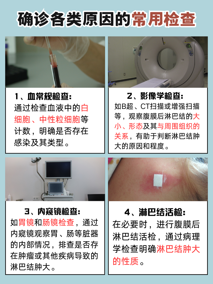 健康警报：腹膜后多发淋巴结是啥信号？