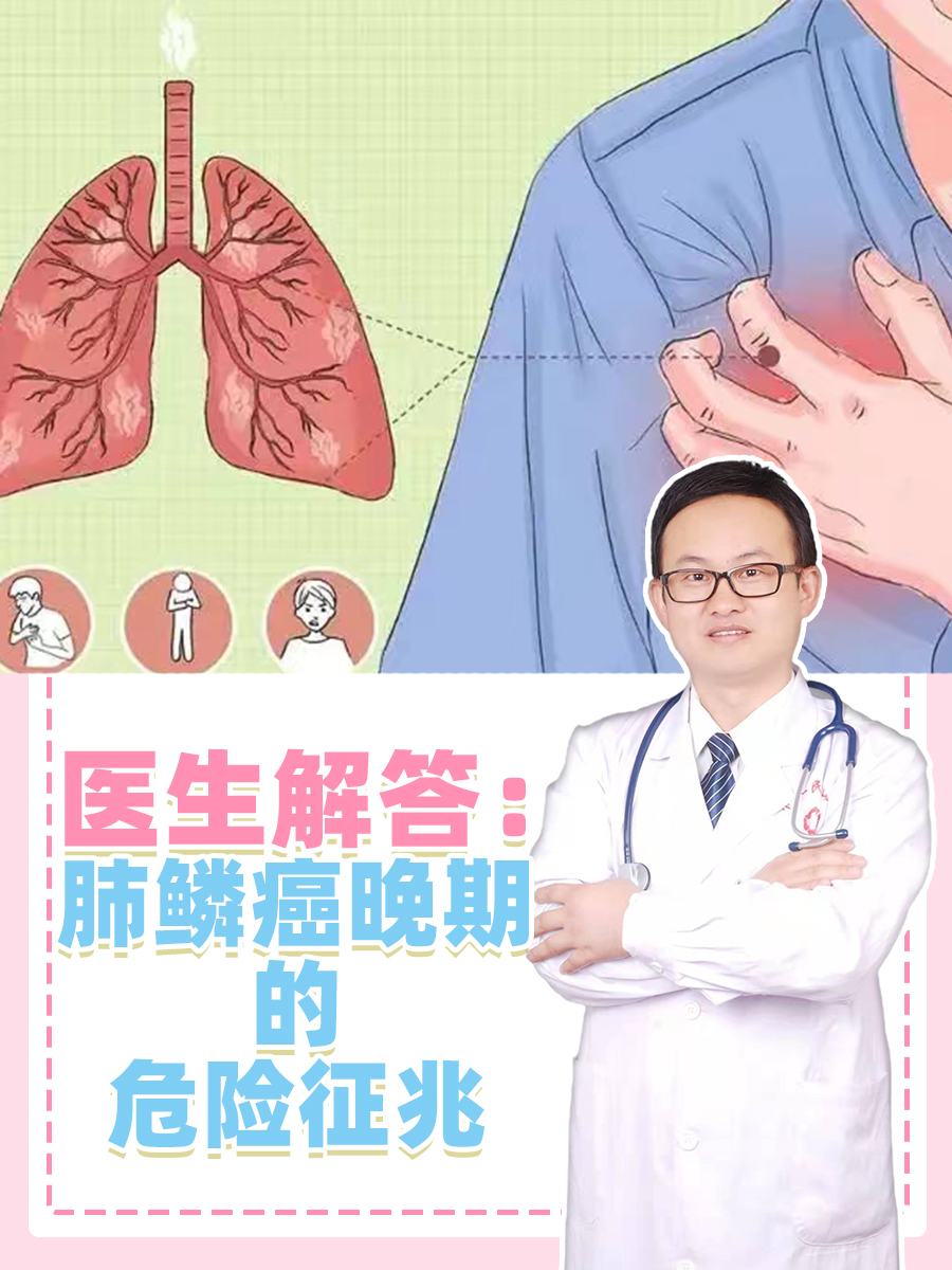 医生解答:肺鳞癌晚期的危险征兆