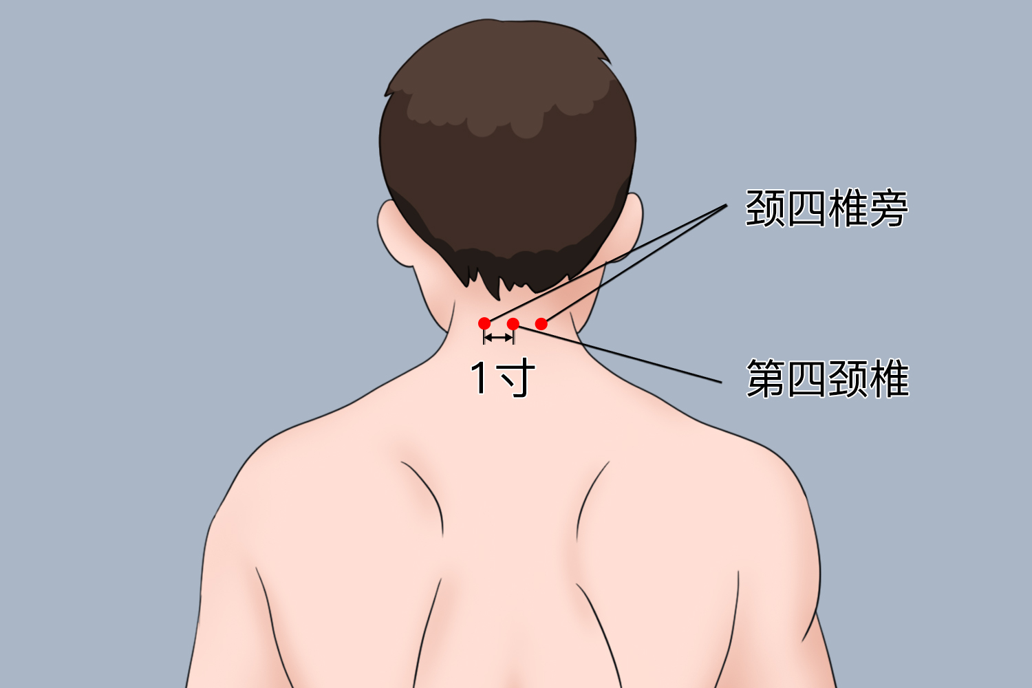 颈四椎旁位置图 颈四椎旁位置图