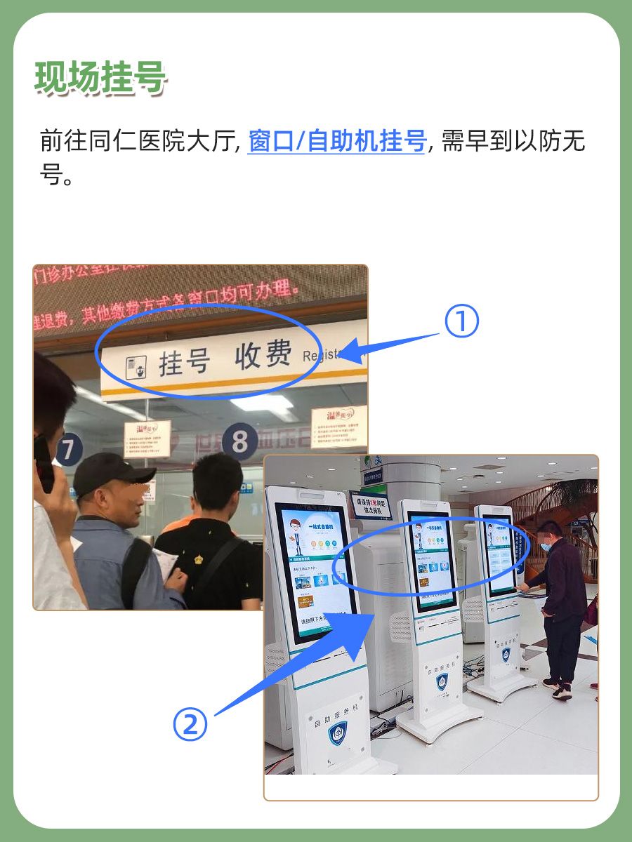 北京同仁医院刘毅医生怎么样？怎么挂号？