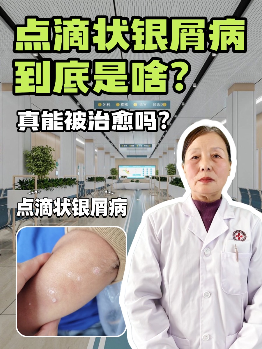 点滴状银屑病到底是啥？真能被治愈吗？