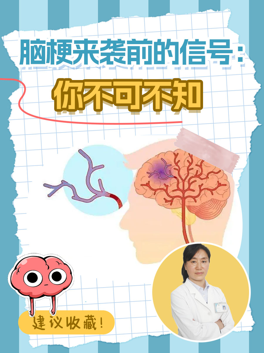 脑梗来袭前的信号：你不可不知