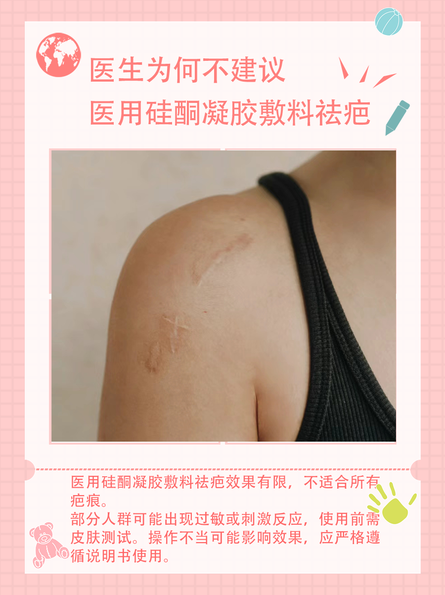 避坑指南！医生为何不建议医用硅酮凝胶敷料祛疤