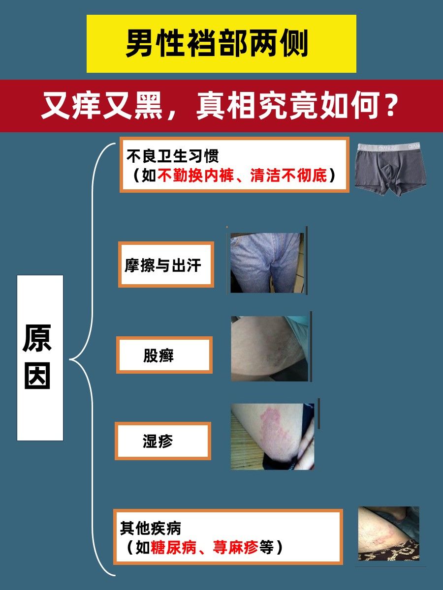 男性裆部两侧又痒又黑，真相究竟如何？