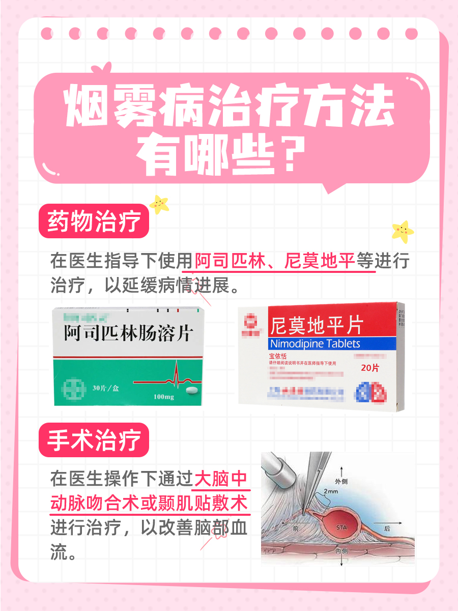 烟雾病是何病?能否治愈?专家详解