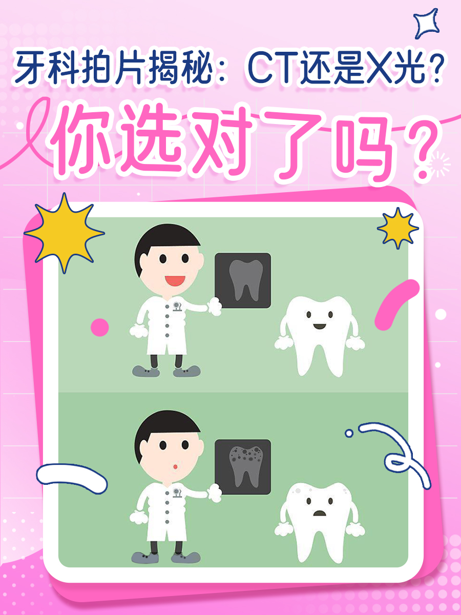 牙科拍片揭秘：CT还是X光？你选对了吗？