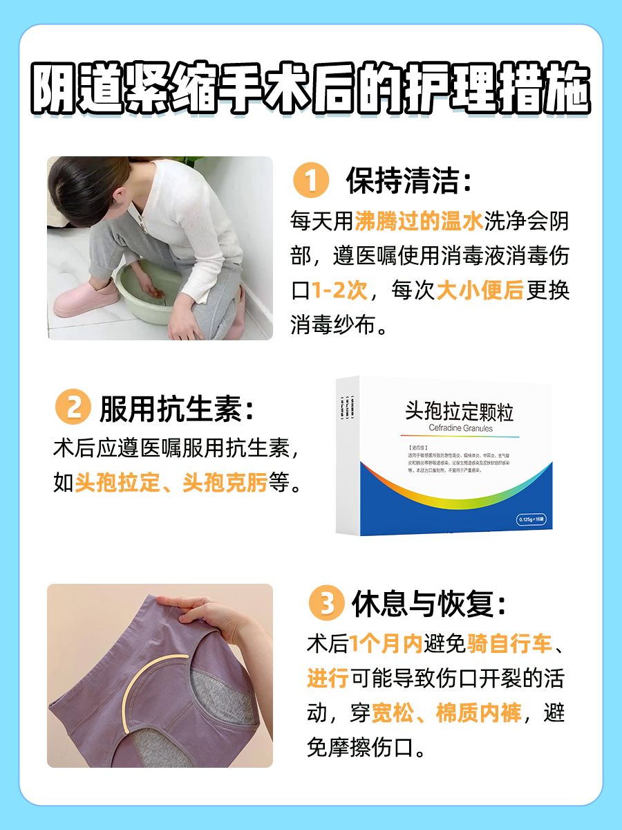 想做阴道收紧?先了解挂号科室哦!