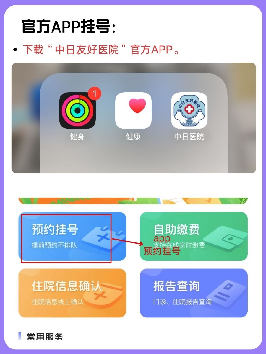 中日友好医院李求兵医生怎么样?怎么挂号?