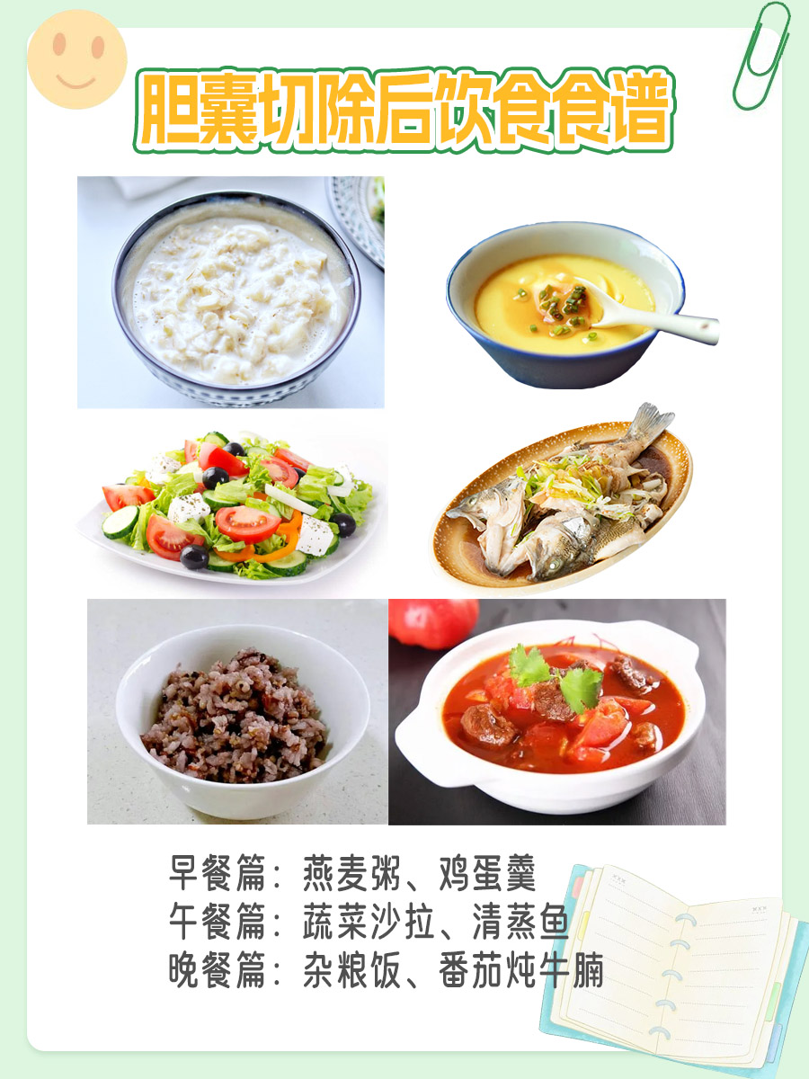 胆囊切除后饮食食谱，建议收藏！