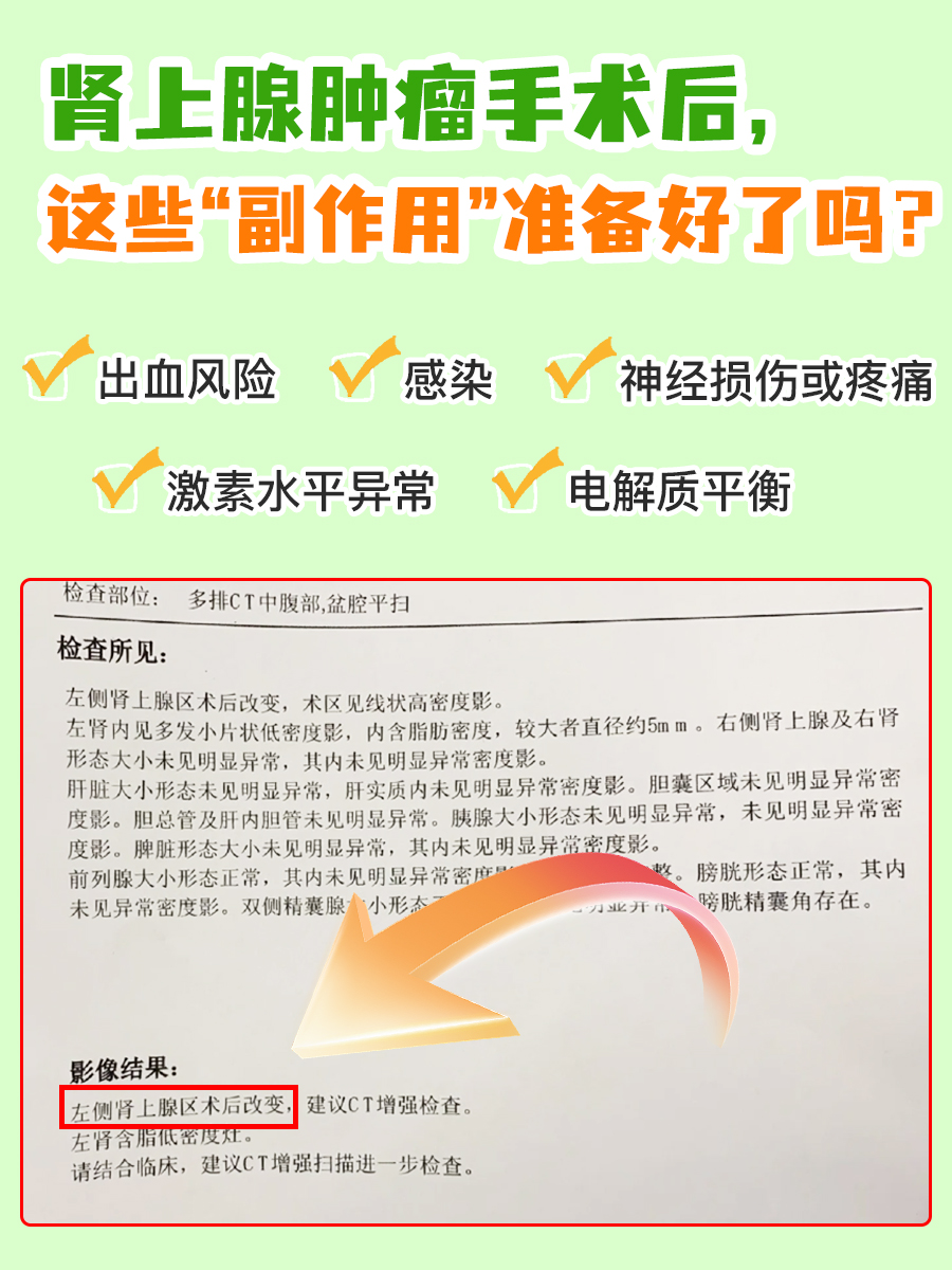 肾上腺肿瘤手术后，这些“副作用”准备好了吗？