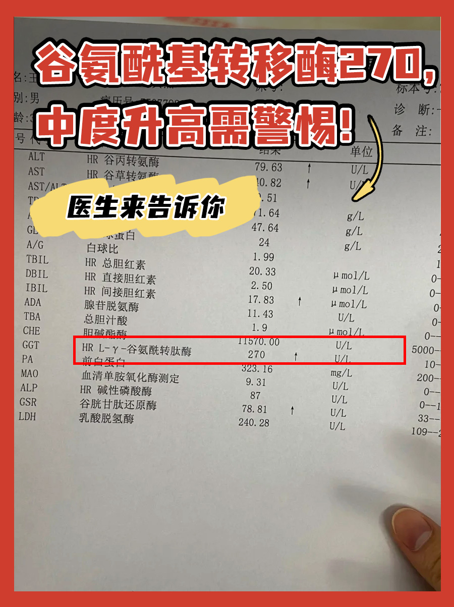 揭秘：谷氨酰基转移酶270U/L是什么程度？