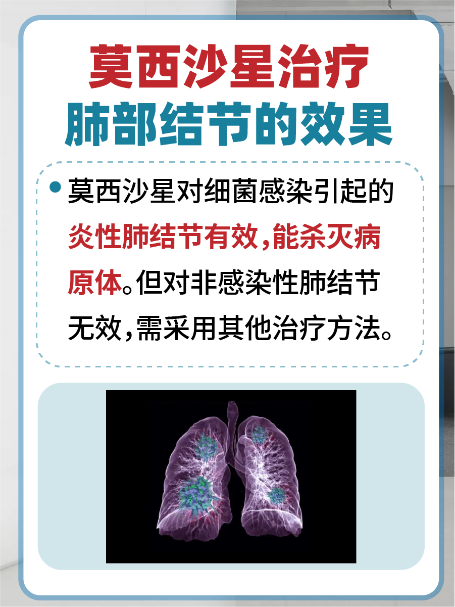 文章带你了解，莫西沙星治疗肺部结节的效果