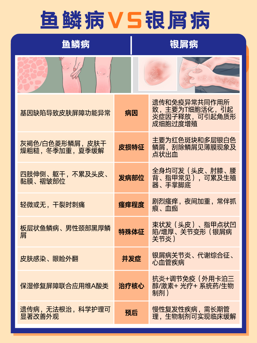 鱼鳞病和银屑病区别，帮你精准避坑！速览！
