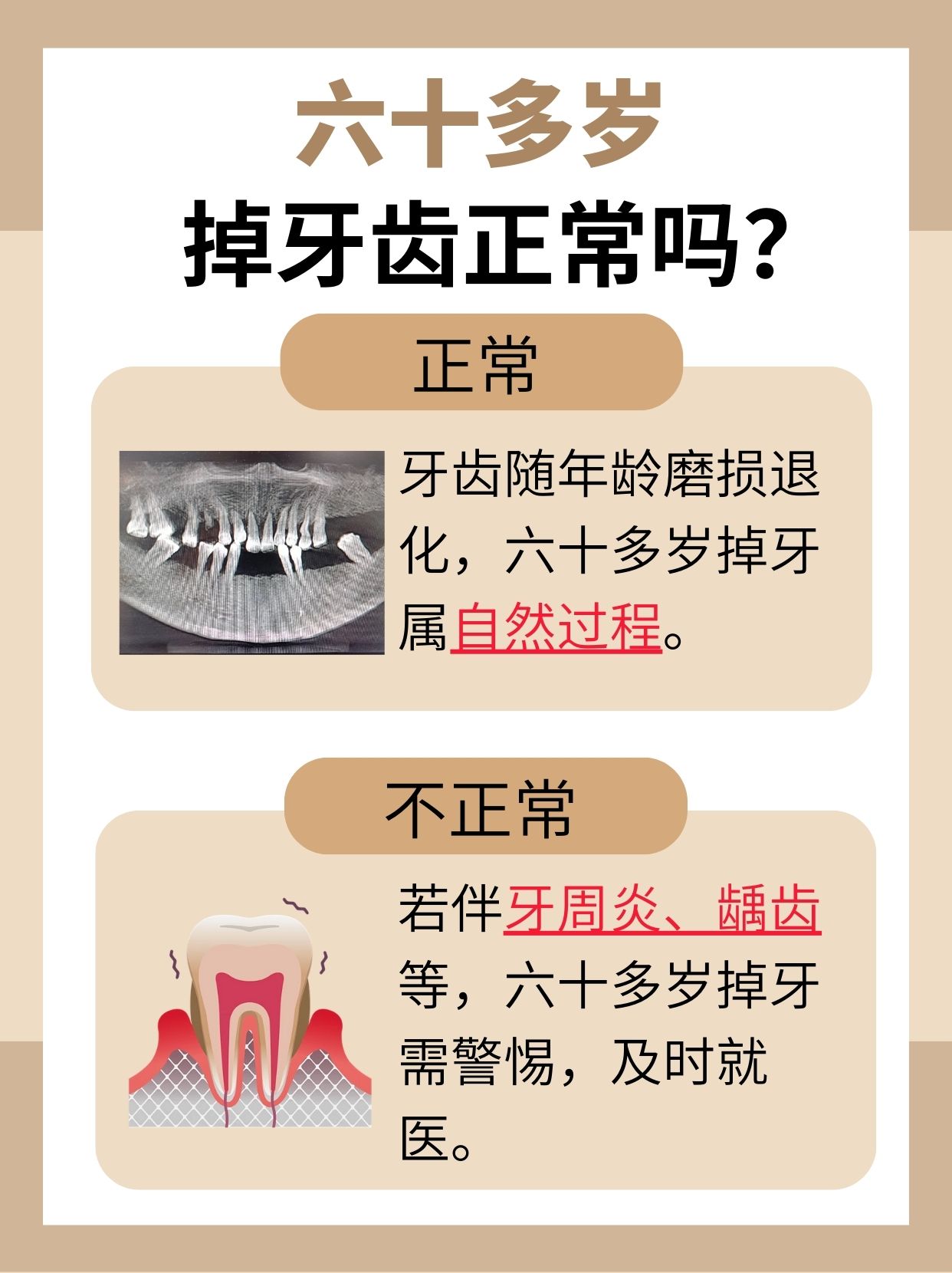 六十多岁掉牙齿是否正常，这篇文章带你了解