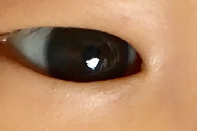 宝宝黑眼珠有层油图 宝宝黑眼珠有层油图