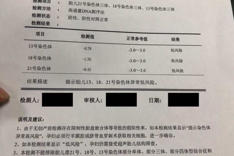 无创DNA检查报告单低风险图 无创DNA检查报告单低风险图