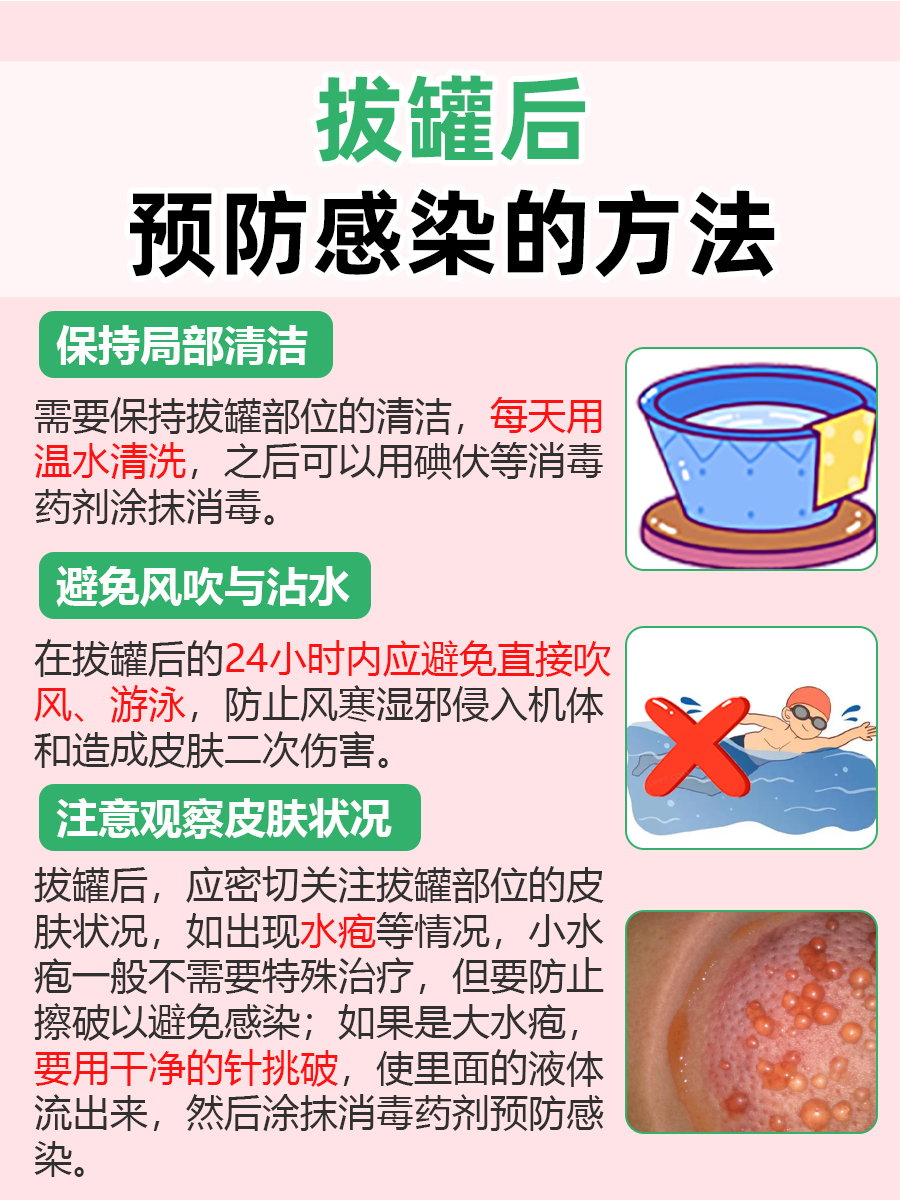 医生解答：拔完罐可以洗澡吗？