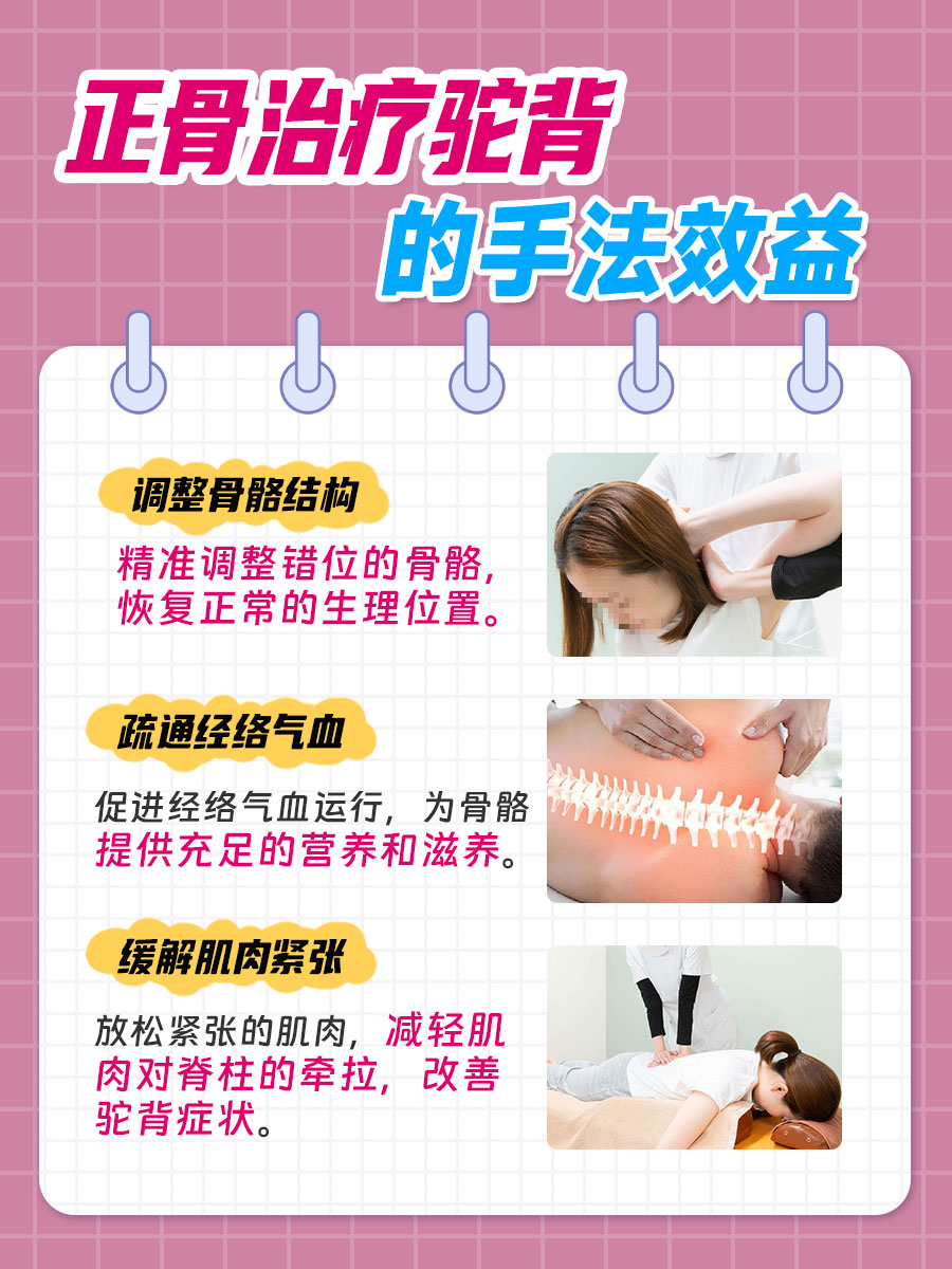 正骨可以治驼背吗？一文了解