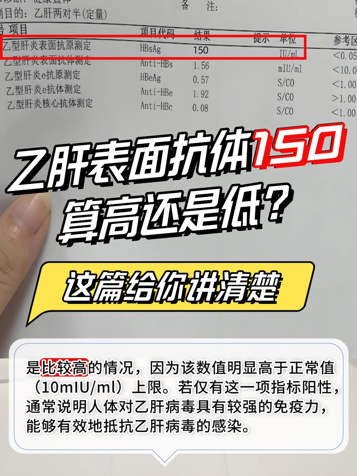 乙肝表面抗体150算高还是低？这篇给你讲清楚