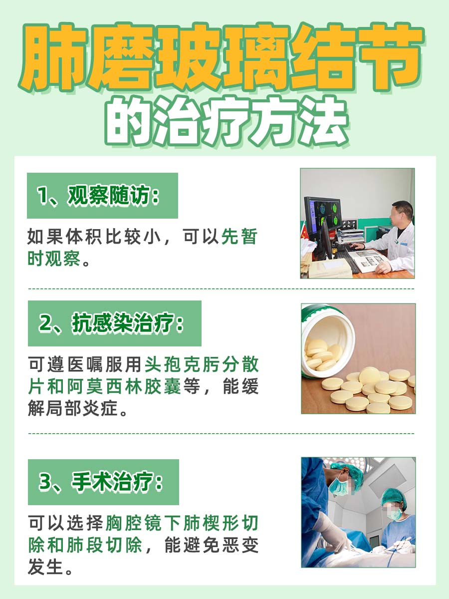 肺磨玻璃结节，严重性和治疗方法大解析