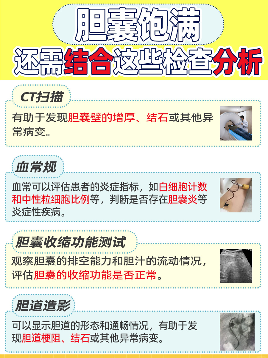 胆囊饱满何意？正常现象or疾病信号？