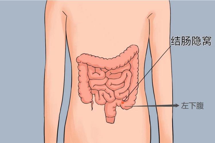 结肠隐窝位置图