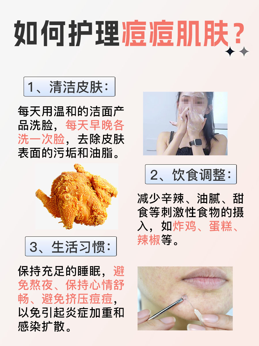 克林霉素甲硝唑搽剂可以去痘痘吗？一文解析