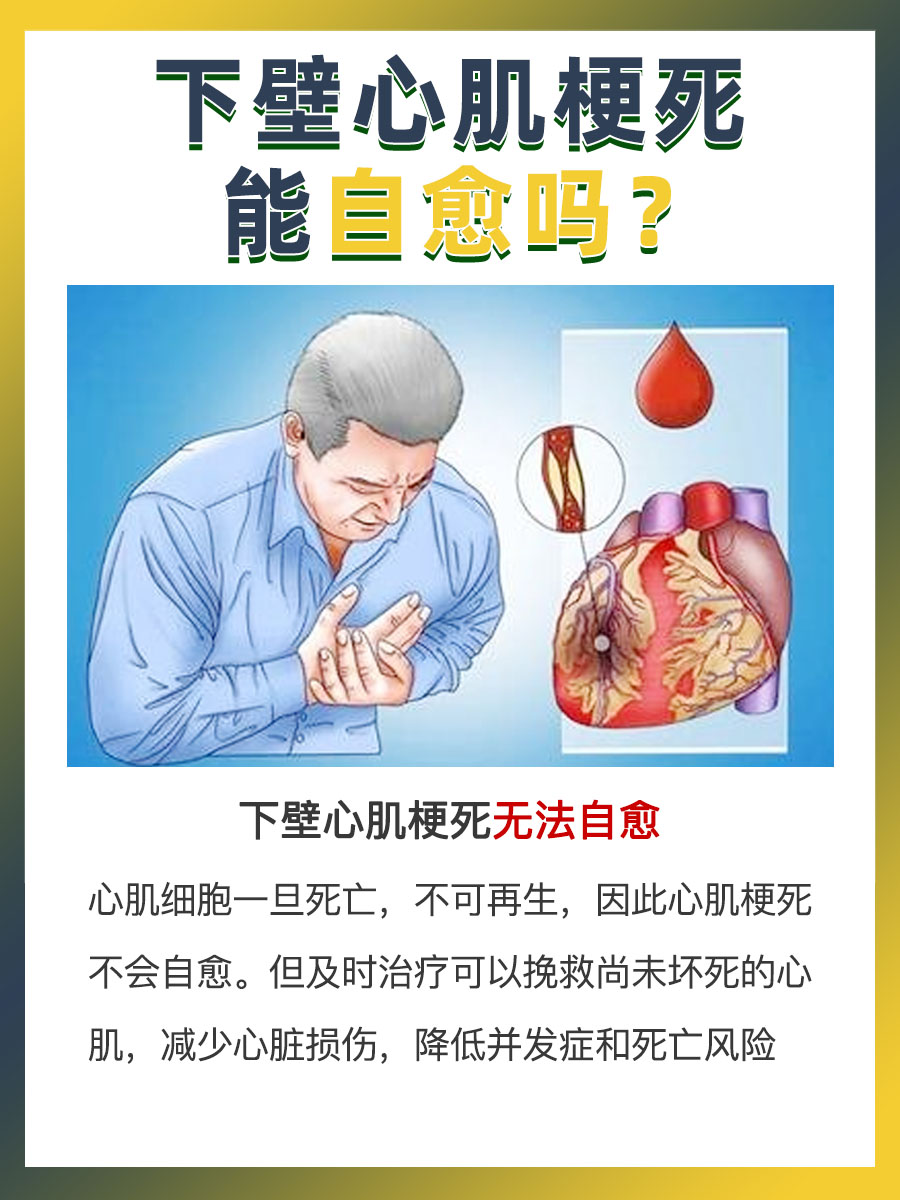 困惑!下壁心肌梗死可以自愈吗?
