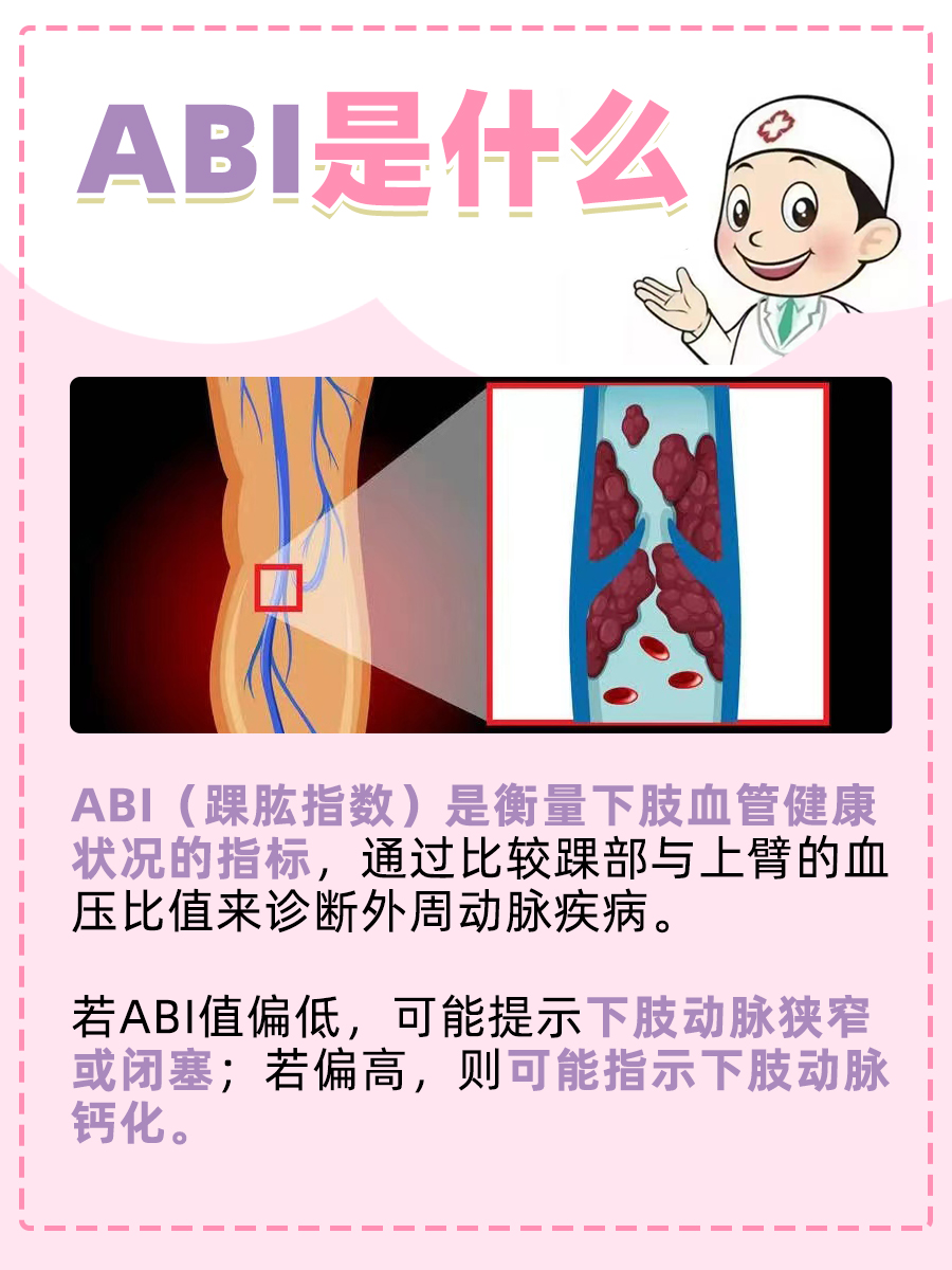 ABI是什么？医学上的含义