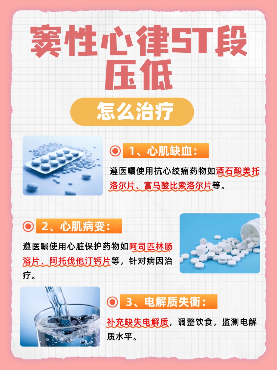 窦性心律ST段压低,原因解析