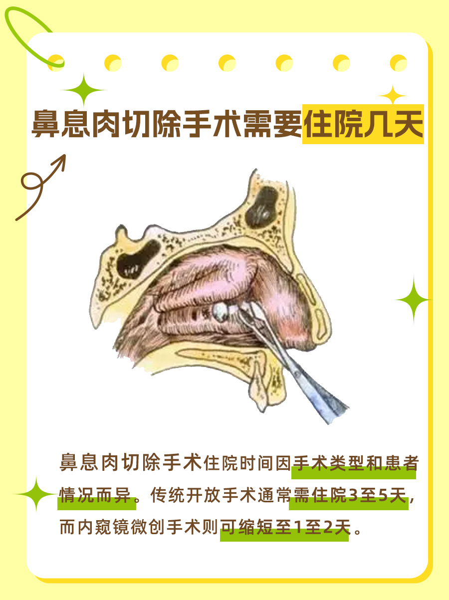 鼻息肉切除手术需住院几天?医生告诉你