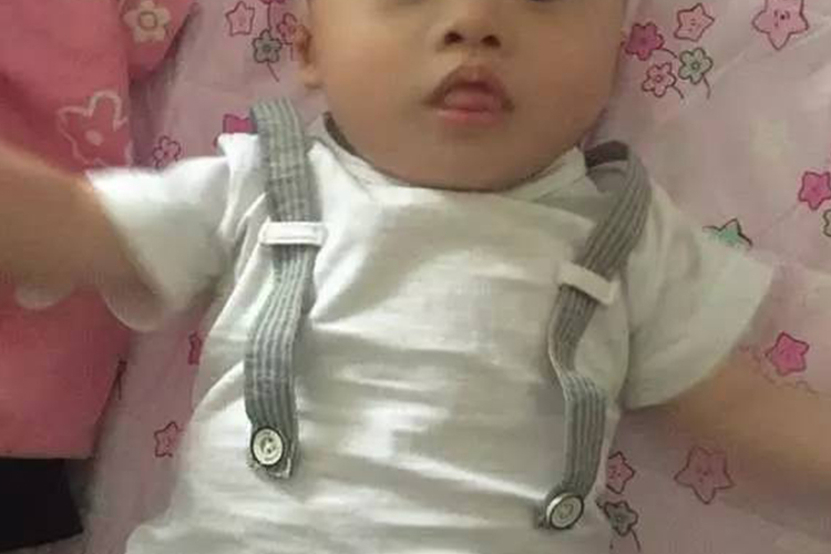 唐氏儿吐舌头图