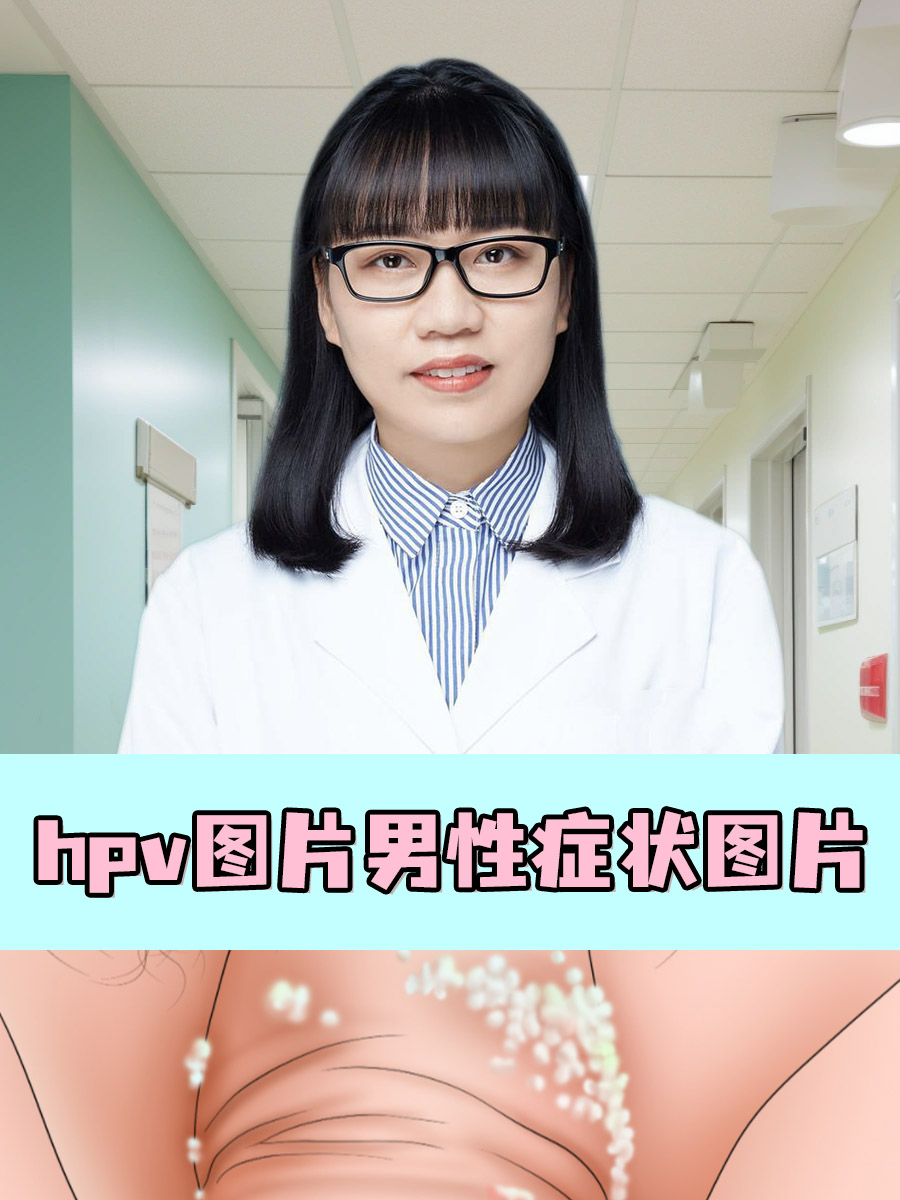 hpv图片男性症状图片