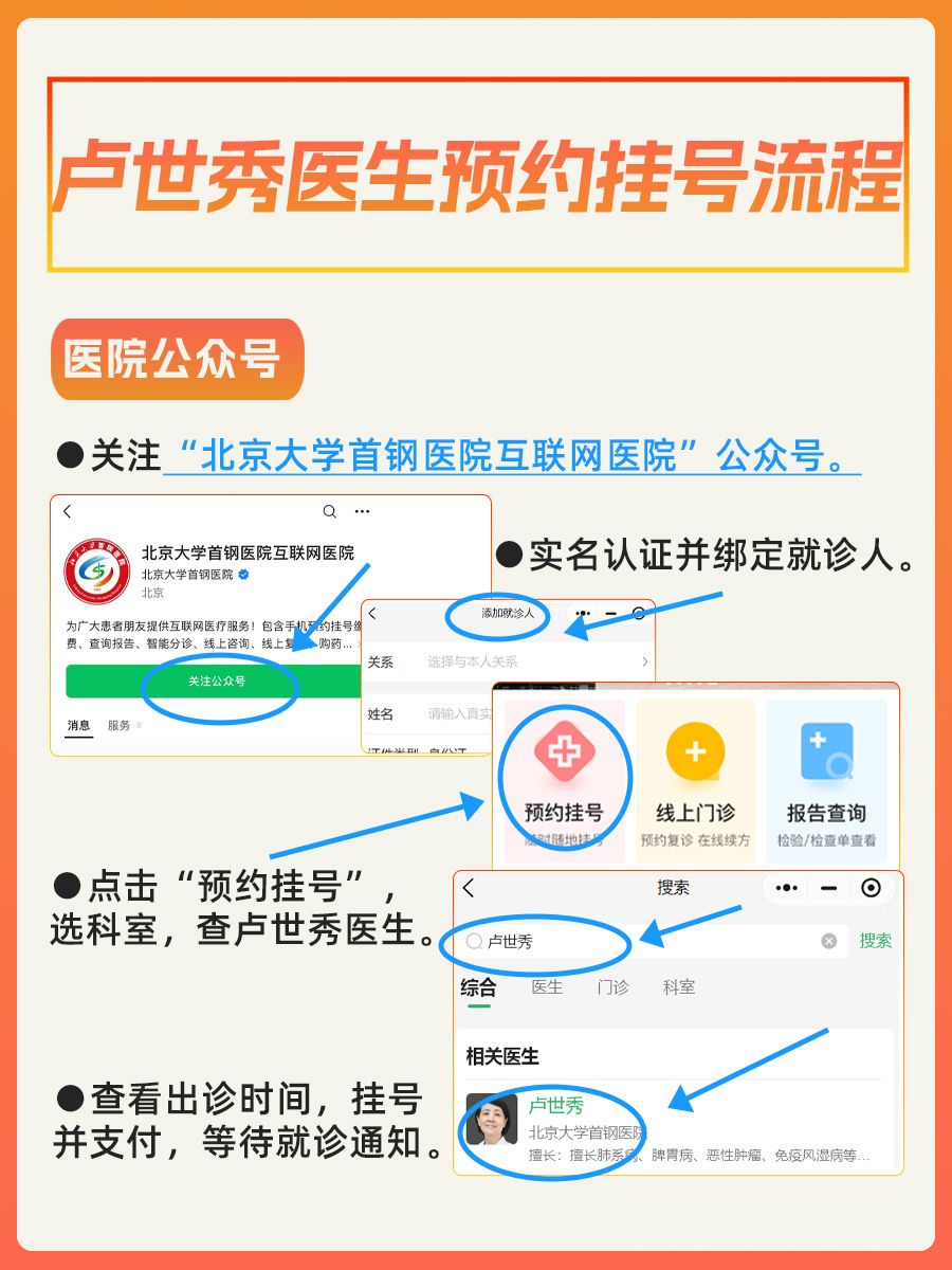 北京大学首钢医院卢世秀医生怎么样？怎么挂号?
