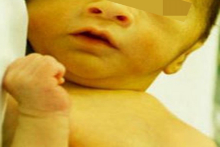 蚕豆病脸上皮肤发黄图