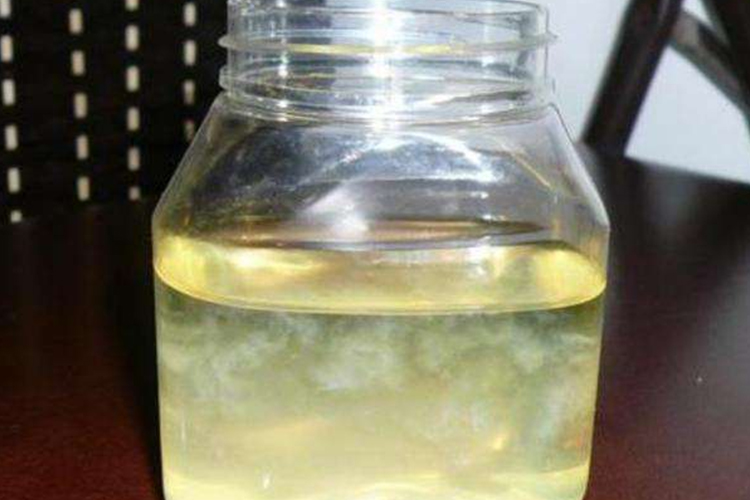 尿里偶尔有白色絮状物图 尿里偶尔有白色絮状物图