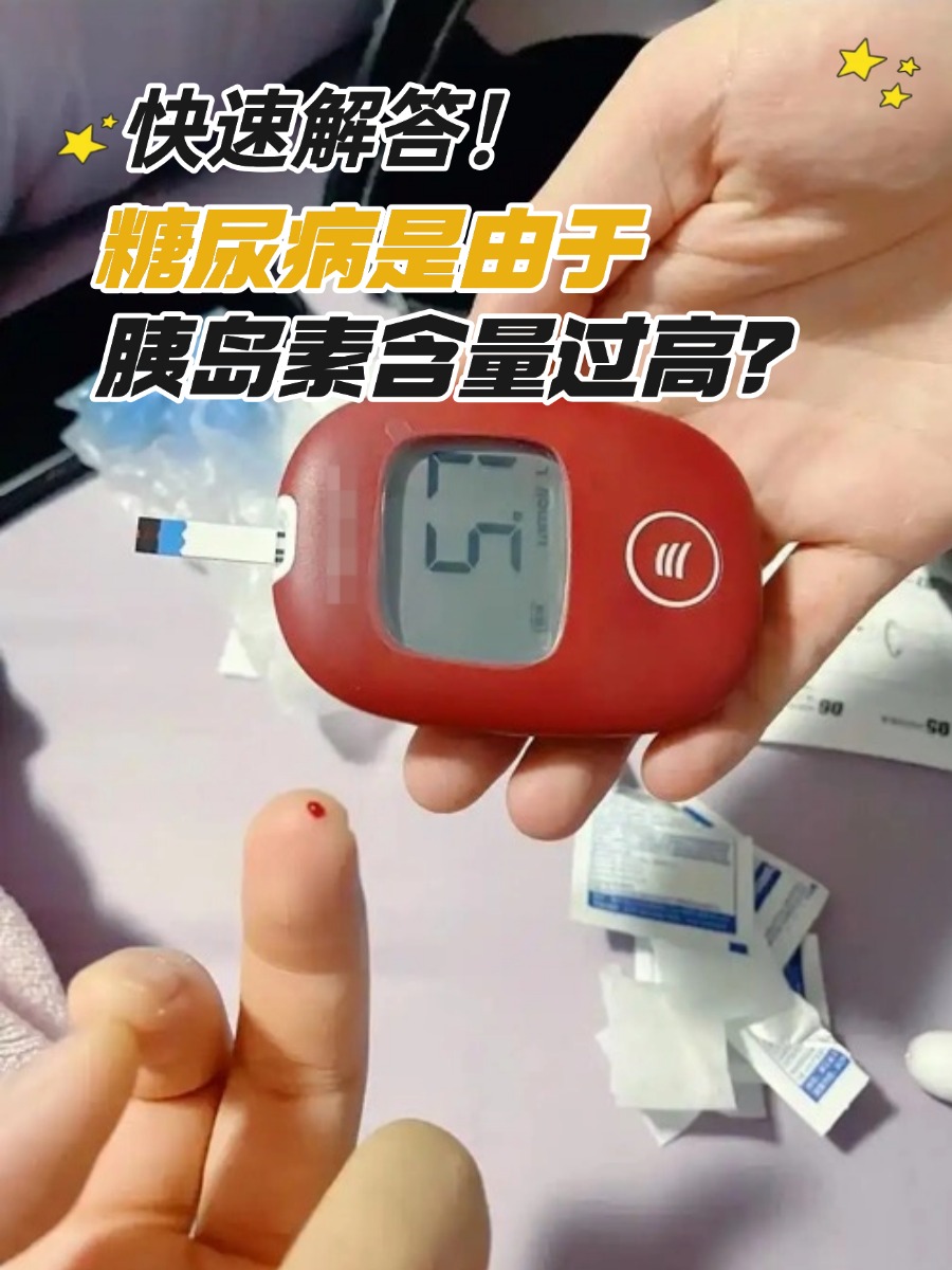 快速解答!糖尿病是由于胰岛素含量过高?