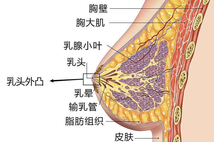 乳头内陷术后凸起图