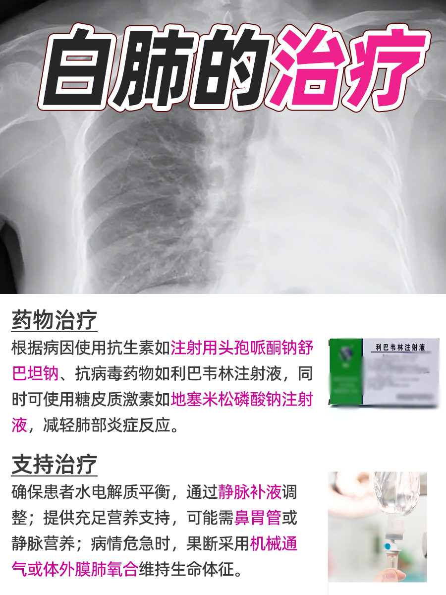 疑惑！出现三个信号，意味着白肺来袭？